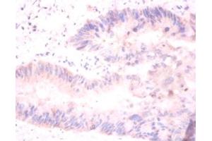 Immunohistochemistry of paraffin-embedded mouse liver using H2AFJ antibody at dilution of 1:100.