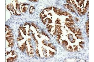 Immunohistochemical staining of paraffin-embedded Human prostate tissue using anti-PANK2 mouse monoclonal antibody. (PANK2 Antikörper)