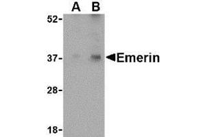 Western blot analysis of Emerin in human skeletal muscle tissue lysate with AP30313PU-N Emerin antibody at (A) 0. (Emerin Antikörper  (N-Term))