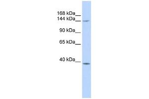 WB Suggested Anti-SMC4 Antibody Titration:  0. (SMC4 Antikörper  (Middle Region))