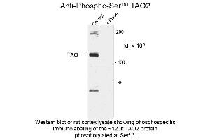 Western blot of Anti-TAO2 pS181 (Rabbit) Antibody - 600-401-E41 Western Blot of Rabbit anti-TAO2 pS181 antibody. (TAO Kinase 2 Antikörper  (pSer181))
