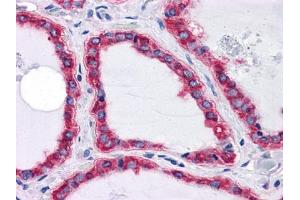 Immunohistochemical analysis of paraffin-embedded human Thyroid tissues using HSPA5 mouse mAb (GRP78 Antikörper)