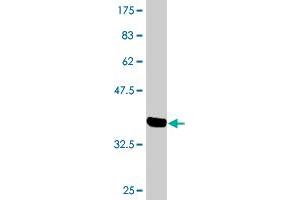 Western Blot detection against Immunogen (36. (CSNK2A2 Antikörper  (AA 1-100))