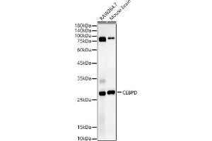 Western blot analysis of extracts of various cell lines, using CEBPD antibody (ABIN7266160) at 1:1340 dilution. (CEBPD Antikörper  (AA 1-269))