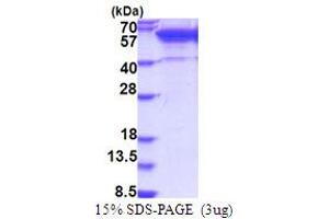 SDS-PAGE (SDS) image for V-Ets Erythroblastosis Virus E26 Oncogene Homolog 2 (ETS2) (AA 1-469) protein (His tag) (ABIN5853782)