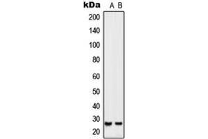 Western blot analysis of SIX6 expression in Jurkat (A), NIH3T3 (B) whole cell lysates.