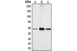 Western blot analysis of Cytochrome P450 4X1 expression in Jurkat (A), mouse kidney (B), rat kidney (C) whole cell lysates. (CYP4X1 Antikörper  (Center))
