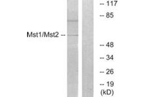 Western blot analysis of extracts from HeLa cells, treated with UV 15', using Mst1/2 (Ab-183) Antibody. (MST1/MST2 (AA 149-198) Antikörper)