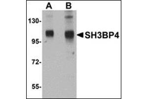 Western blot analysis of SH3BP4 in rat lung tissue lysate with this product at (A) 1 and (B) 2 μg/ml. (SH3BP4 Antikörper  (C-Term))