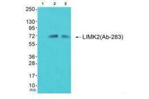 Western blot analysis of extracts from 293 cells (Lane 2) and cos-7 cells (Lane 3), using LIMK2 (Ab-283) antiobdy. (LIMK2 Antikörper  (Ser283))