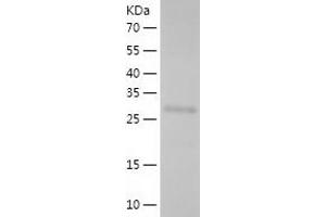 Western Blotting (WB) image for Hyaluronan-Mediated Motility Receptor (RHAMM) (HMMR) (AA 184-438) protein (His tag) (ABIN7123373)