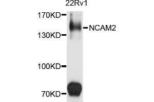 Western blot analysis of extracts of 22Rv1 cells, using NCAM2 antibody (ABIN5972146) at 1/1000 dilution. (NCAM2 Antikörper)