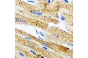 Immunohistochemical analysis of GPAM staining in mouse heart formalin fixed paraffin embedded tissue section. (GPAM Antikörper)