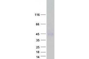 Western Blotting (WB) image for Thyroid Stimulating Hormone Receptor (TSHR) (Transcript Variant 3) protein (Myc-DYKDDDDK Tag) (ABIN2733690)
