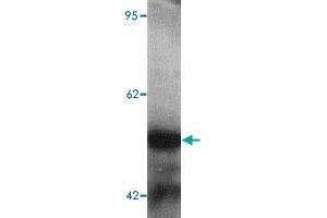 Western blot analysis of human kidney tissue lysate with TTYH2 polyclonal antibody  at 1 ug/mL. (TTYH2 Antikörper  (N-Term))