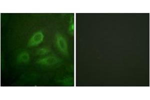 Immunofluorescence analysis of HeLa cells, using DRP-2 (Phospho-Thr514) Antibody. (DRP2 Antikörper  (pThr514))