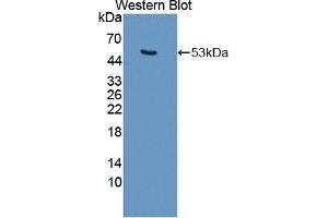 Detection of Recombinant KRT25, Mouse using Polyclonal Antibody to Keratin 25 (KRT25) (Keratin 25 Antikörper  (AA 1-446))