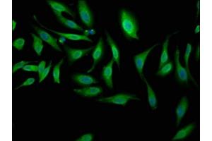 Immunofluorescence staining of Hela cells with ABIN7169088 at 1:100, counter-stained with DAPI.
