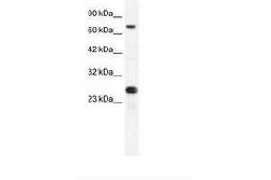Image no. 2 for anti-Minichromosome Maintenance Complex Component 6 (MCM6) (C-Term) antibody (ABIN202926) (MCM6 Antikörper  (C-Term))