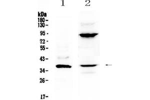 Western blot analysis of IL12B using anti-IL12B antibody . (IL12B Antikörper  (AA 23-253))