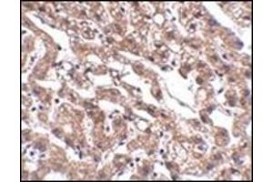 Immunohistochemistry of MACC1 in human liver tissue with this product at 2.