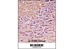 Mouse Prkaca/Prkacb Antibody immunohistochemistry analysis in formalin fixed and paraffin embedded mouse brain tissue followed by peroxidase conjugation of the secondary antibody and DAB staining. (PRKACA/PRKACB Antikörper  (C-Term))