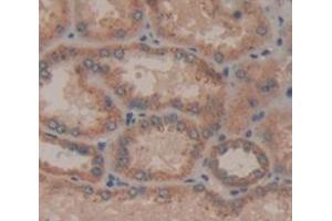 IHC-P analysis of Human Tissue, with DAB staining. (IL21 Receptor Antikörper  (AA 23-185))
