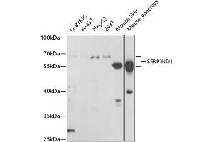 Western blot analysis of extracts of various cell lines, using SERPIND1 antibody (ABIN6131316, ABIN6147598, ABIN6147599 and ABIN6221548) at 1:1000 dilution. (SERPIND1 Antikörper  (AA 20-290))