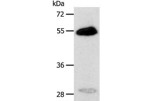 Western Blot analysis of Human liver cancer tissue using CA14 Polyclonal Antibody at dilution of 1:400 (CA14 Antikörper)