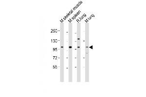 All lanes : Anti-Fgfr4 Antibody (Center) at 1:2000 dilution Lane 1: mouse skeletal muscle lysates Lane 2: mouse spleen lysates Lane 3: rat lung lysates Lane 4: mouse lung lysates Lysates/proteins at 20 μg per lane. (FGFR4 Antikörper  (AA 448-482))