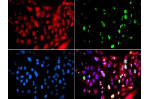 Immunofluorescence analysis of GFP-RNF168 transgenic U2OS cells using UIMC1 antibody (ABIN6128891, ABIN6149915, ABIN6149916 and ABIN6223082). (UIMC1 Antikörper  (AA 1-230))