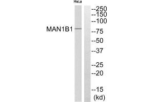 Western Blotting (WB) image for anti-Mannosidase, Alpha, Class 1B, Member 1 (MAN1B1) (Internal Region) antibody (ABIN1851304) (MAN1B1 Antikörper  (Internal Region))