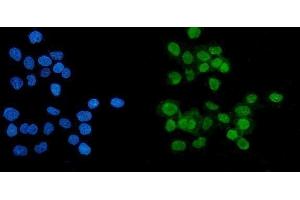 IF analysis of PARP using anti-PARP antibody (ABIN7602276).