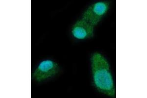 IF analysis of YTHDC2 using anti-YTHDC2 antibody (ABIN7599661). (YTHDC2 Antikörper  (AA 105-1231))