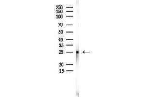 anti-Charged Multivesicular Body Protein 4C (CHMP4C) antibody