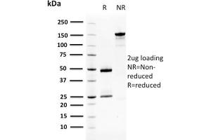 SDS-PAGE Analysis Purified SqCC Antigen 1 Mouse Monoclonal Antibody (CPTC-SERPINB3-2).