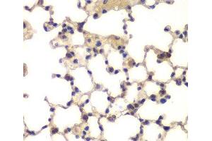 Immunohistochemistry of paraffin-embedded Mouse lung using CXXC1 Polyclonal Antibody at dilution of 1:200 (40x lens). (CXXC1 Antikörper)