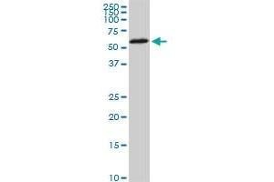 HDAC1 monoclonal antibody (M02), clone 3E1. (HDAC1 Antikörper  (AA 1-482))