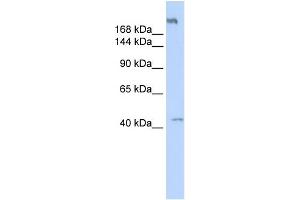 WB Suggested Anti-POLR3A Antibody Titration:  0. (POLR3A Antikörper  (Middle Region))