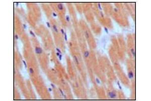 Immunohistochemical analysis of paraffin-embedded human normal myocardium, showing cytoplasmic localization using BNP3 mouse mAb with DAB staining. (BNP Antikörper)