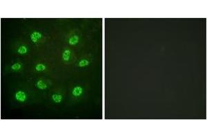 Immunofluorescence analysis of HuvEc cells, using Estrogen Receptor-beta (Phospho-Ser105) Antibody. (ESR2 Antikörper  (pSer105))