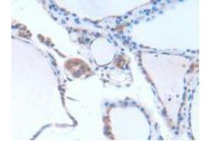 IHC-P analysis of Human Thyroid Tissue, with DAB staining. (GNB1L Antikörper  (AA 69-247))