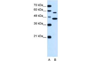 WB Suggested Anti-SLC39A5 Antibody Titration:  0. (SLC39A5 Antikörper  (N-Term))
