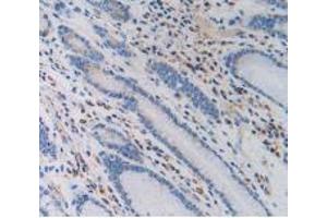 IHC-P analysis of Human Stomach Tissue, with DAB staining. (PZP Antikörper  (AA 1212-1391))