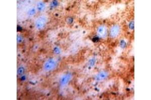 Used in DAB staining on fromalin fixed paraffin-embedded brain tissue (S100 Protein (S100) (AA 1-94) Antikörper)