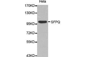 Western Blotting (WB) image for anti-Splicing Factor Proline/glutamine-Ric (SFPQ) (AA 578-707) antibody (ABIN6214046) (SFPQ Antikörper  (AA 578-707))