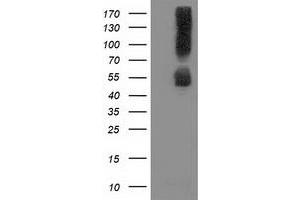 Image no. 2 for anti-Sequestosome 1 (SQSTM1) antibody (ABIN1499987) (SQSTM1 Antikörper)