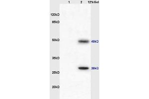 Lane 1: mouse spleen lysates Lane 2: mouse heart lysates probed with Anti IgJ Polyclonal Antibody, Unconjugated  at 1:3000 90min in 37˚C. (IGJ Antikörper  (AA 45-70))