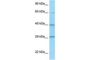 Image no. 1 for anti-Complement Factor H-Related 1 (CFHR1) (AA 183-232) antibody (ABIN6748449) (CFHR1 Antikörper  (AA 183-232))