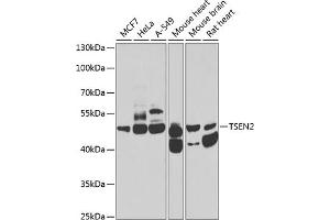 Western blot analysis of extracts of various cell lines, using TSEN2 antibody (ABIN6131375, ABIN6149615, ABIN6149616 and ABIN6223809) at 1:1000 dilution. (TSEN2 Antikörper  (AA 1-220))